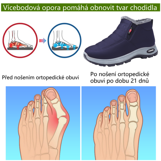 ⚡Omezený sleva 50 % - Ergonomické ortopedické boty - Pro úlevu od bolesti nohou, zad a kloubů - Unisex