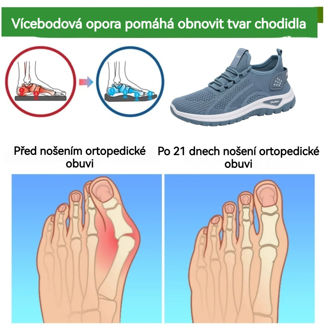 🔥 30% de descuento hoy - ¡no te lo pierdas! ⏰ Zapatos ortopédicos de diseño ergonómico con soporte para el arco👞 Alivia fácilmente el dolor de pie ✅Cómodo y transpirable