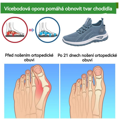 🔥 30% de descuento hoy - ¡no te lo pierdas! ⏰ Zapatos ortopédicos de diseño ergonómico con soporte para el arco👞 Alivia fácilmente el dolor de pie ✅Cómodo y transpirable