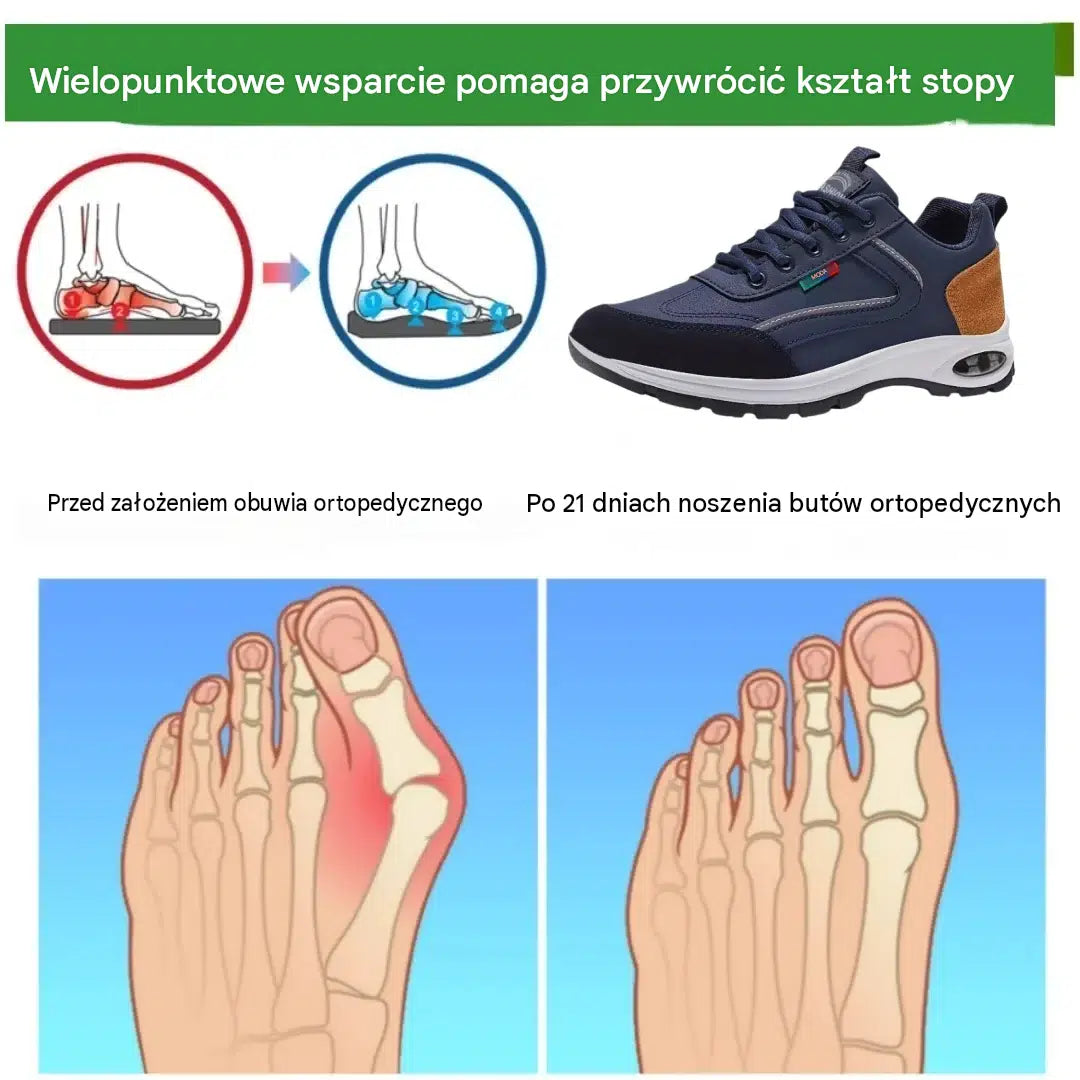 🎉 ¡Último día! ¡30% de descuento! ✅ Calzado ortopédico diseñado específicamente para personas con problemas en los pies; ofrece soporte para el arco y alivia el dolor de espalda, articulaciones y pies.