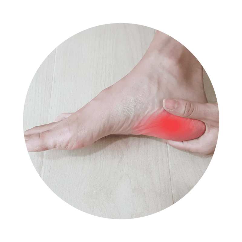 ALIVIO PARA LA FASCITIS PLANTAR